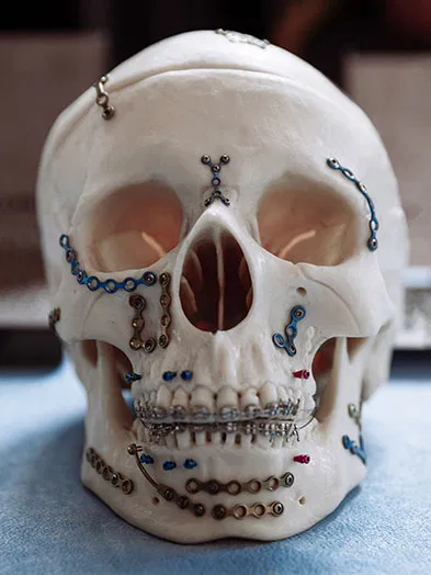 Consultation for TMJ and maxillofacial disorder management