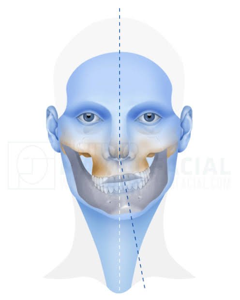 Maxillofacial trauma reconstruction and jaw stabilization