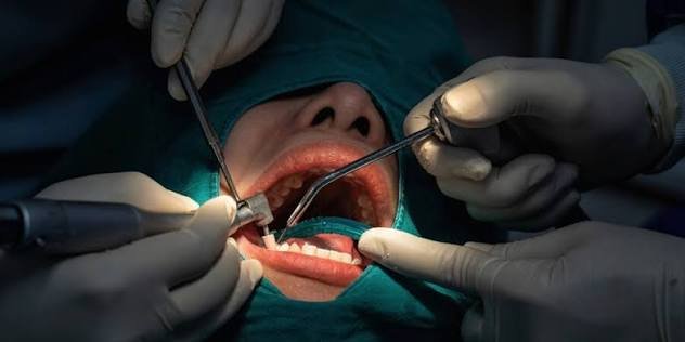 Minor oral surgery performed in an ambulatory setting
