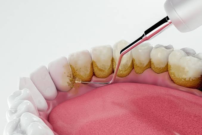 Oral health diagnostic evaluation